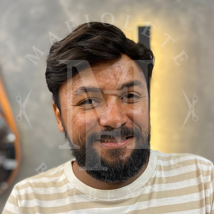 20250508-protese-depois