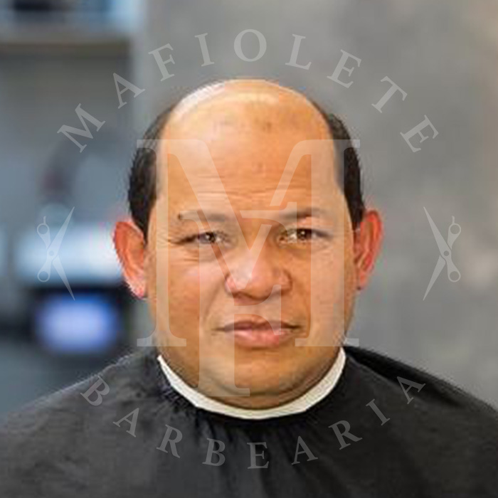 20250509-protese-antes